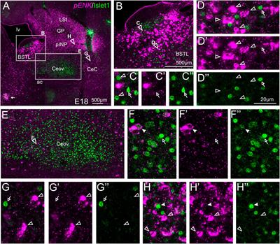 Developmental-Based Classification of Enkephalin and Somatostatin Containing Neurons of the Chicken Central Extended Amygdala